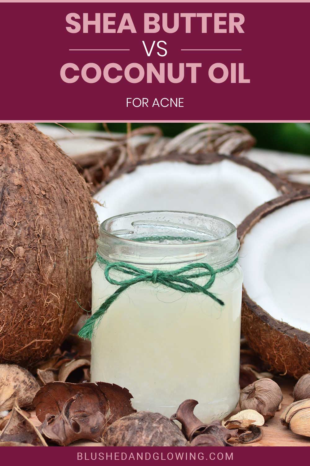 A glass jar full of coconut oil infront of fresh coconut - Shea Butter Vs Coconut Oil for Acne.